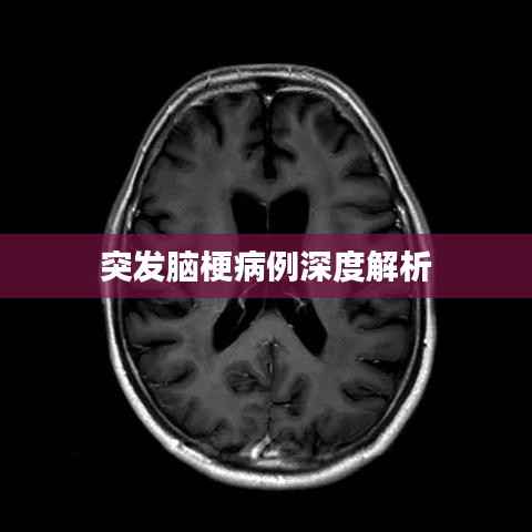 突发脑梗病例深度解析