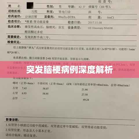 突发脑梗病例深度解析