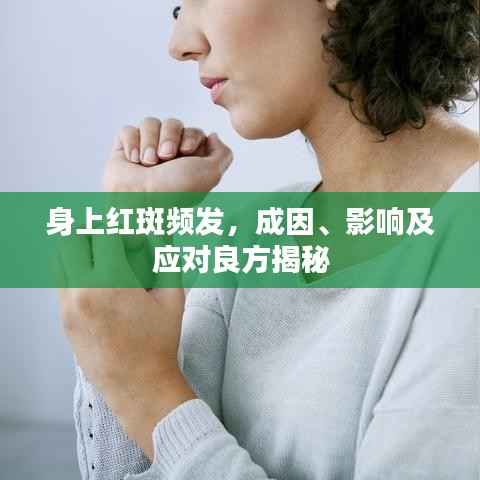 身上红斑频发,成因、影响及应对良方揭秘
